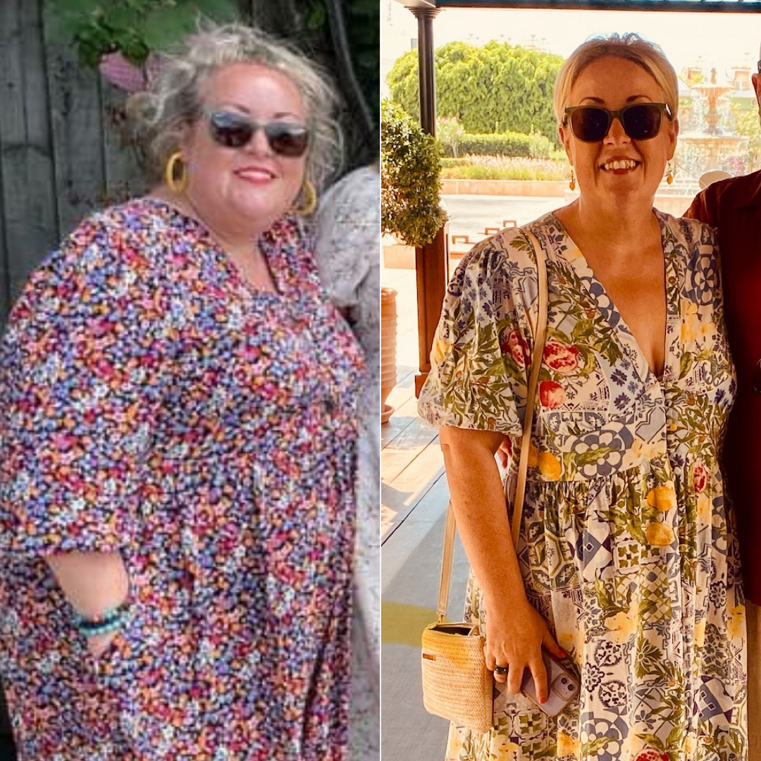 Before and After