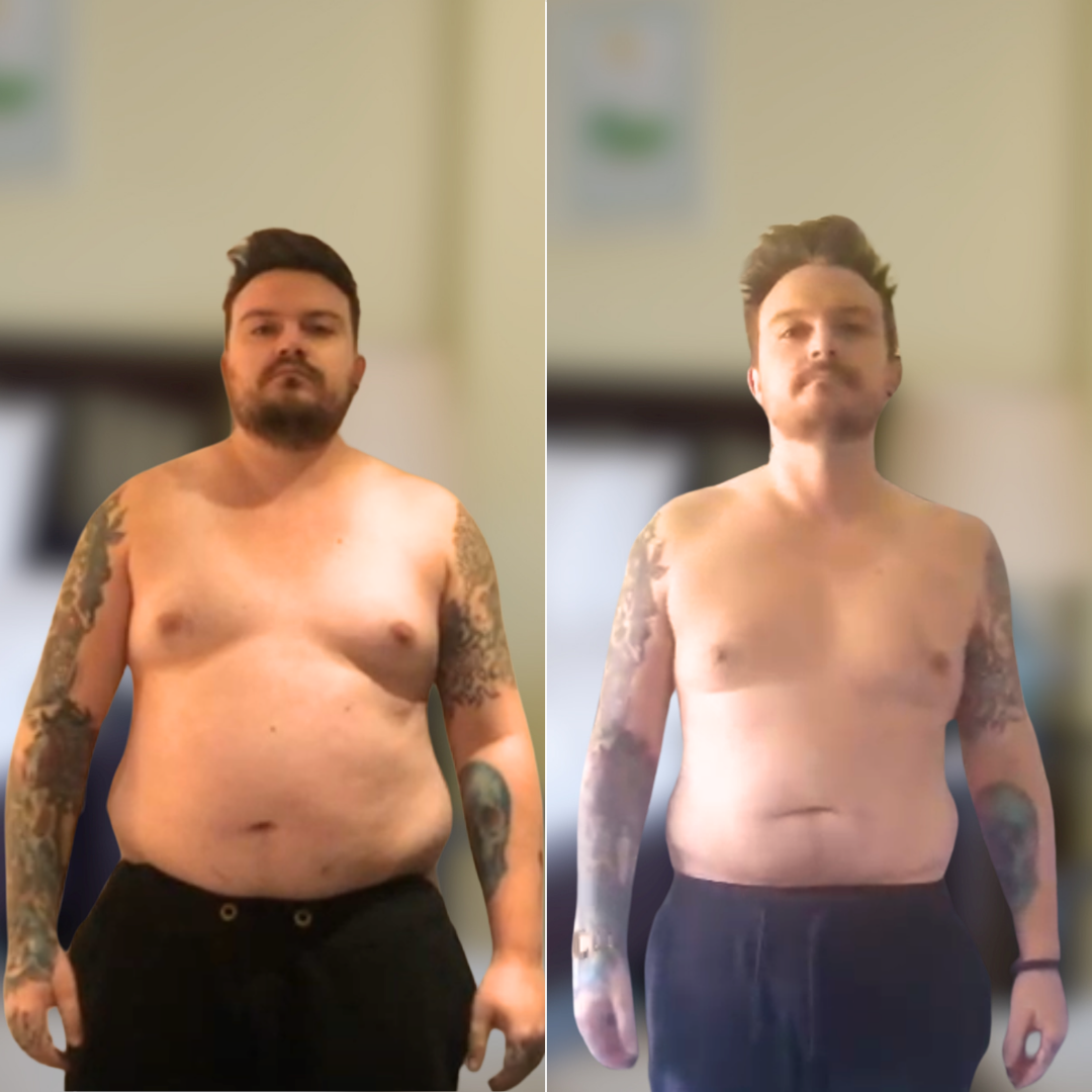 Before and After