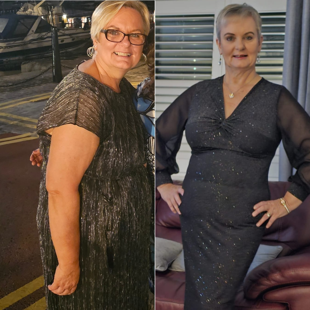 Before and After