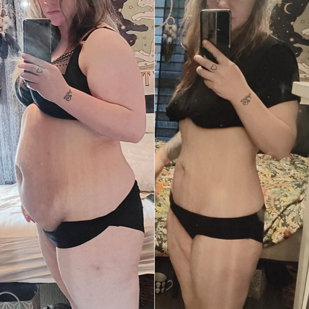 Before and After