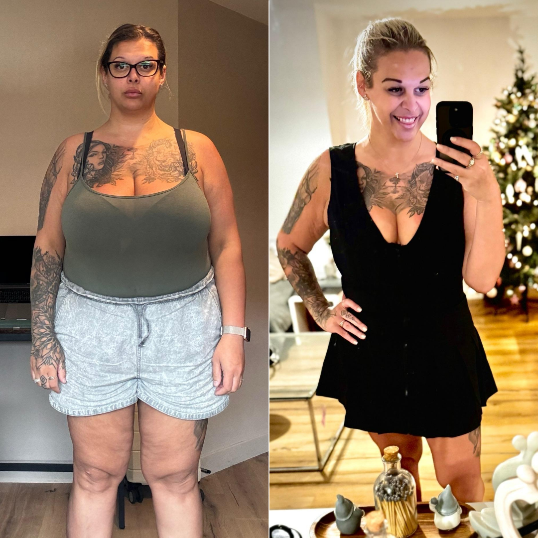 Before and After