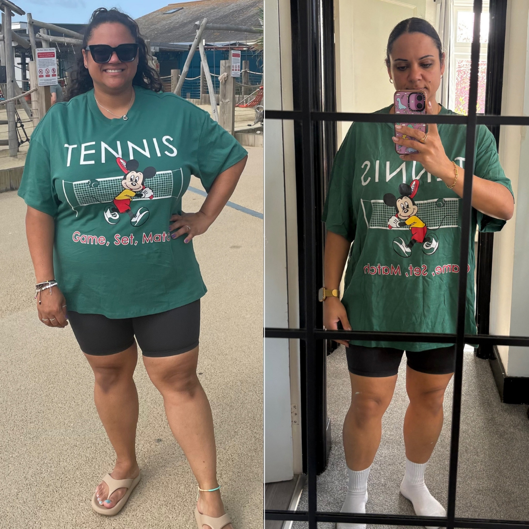 Before and After