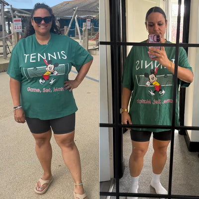 Before and After