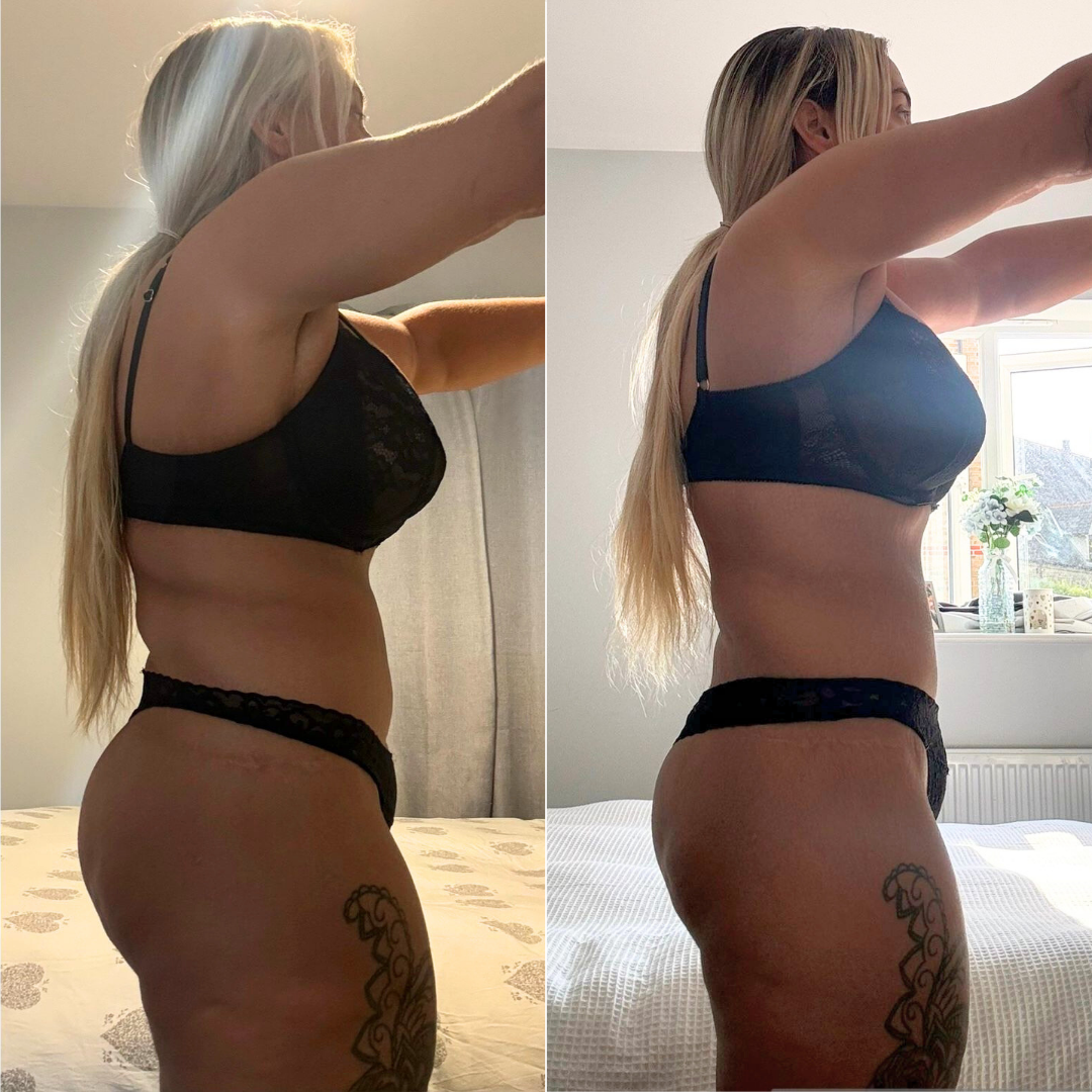 Before and After